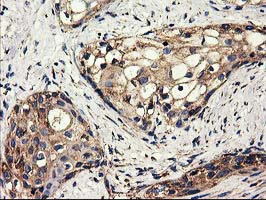 m01117 anti clpp mouse monoclonal antibody clone id oti1f6 ihc testing 5