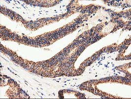 m01117 anti clpp mouse monoclonal antibody clone id oti1f6 ihc testing 6