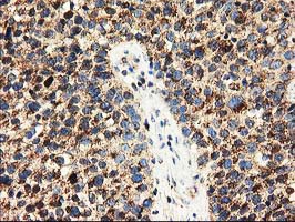 m01117 anti clpp mouse monoclonal antibody clone id oti1f6 ihc testing 7