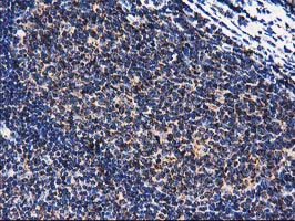 m01117 anti clpp mouse monoclonal antibody clone id oti1f6 ihc testing 8