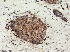 m01117 anti clpp mouse monoclonal antibody clone id oti1f6 ihc testing 9