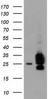 m01117 anti clpp mouse monoclonal antibody clone id oti1f6 wb testing 1