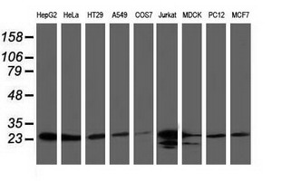 m01117 anti clpp mouse monoclonal antibody clone id oti1f6 wb testing 2