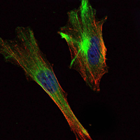 Immunofluorescent staining data of CRTC2 using Anti-TORC2 CRTC2 Monoclonal Antibody (M01118)