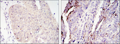 Immunohistochemistry validation of CRTC2 using Anti-TORC2 CRTC2 Monoclonal Antibody (M01118)