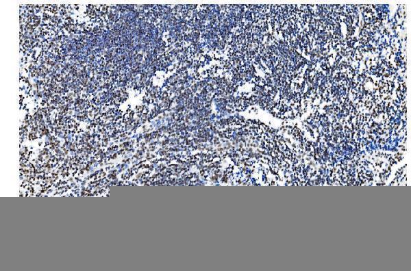 m01129 1 nrf1 primary antibodies ihc testing 14