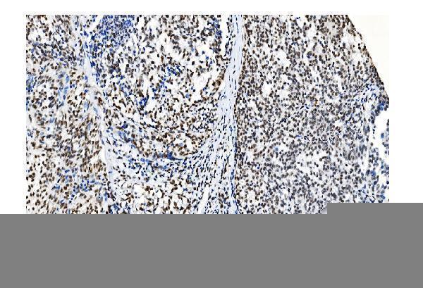 m01129 1 nrf1 primary antibodies ihc testing 18