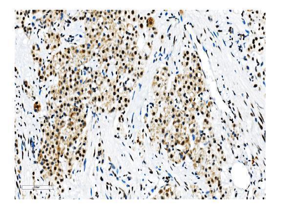 m01129 1 nrf1 primary antibodies ihc testing 20
