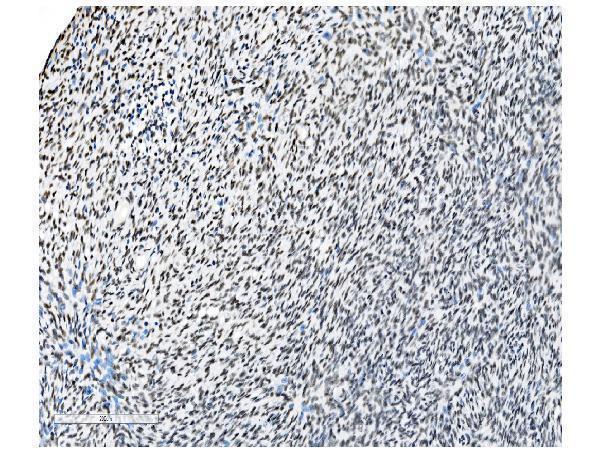 m01129 1 nrf1 primary antibodies ihc testing 21