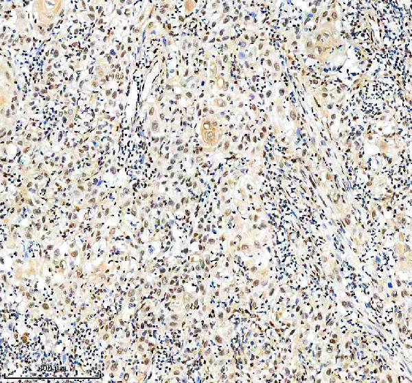  IHC analysis of NRF1 using anti-NRF1 antibody (M01129)