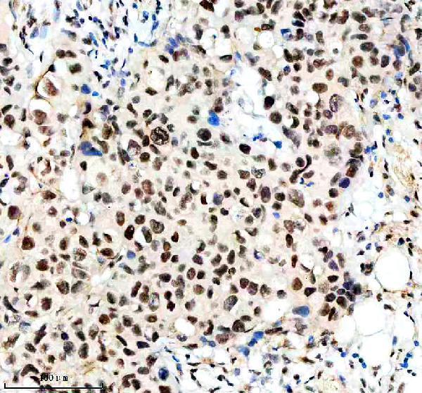  IHC analysis of NRF1 using anti-NRF1 antibody (M01129)