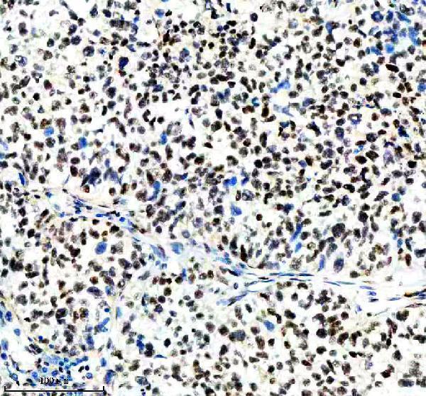 m01129 nrf1 primary antibodies ihc testing 8