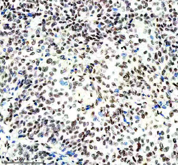 m01129 nrf1 primary antibodies ihc testing 9