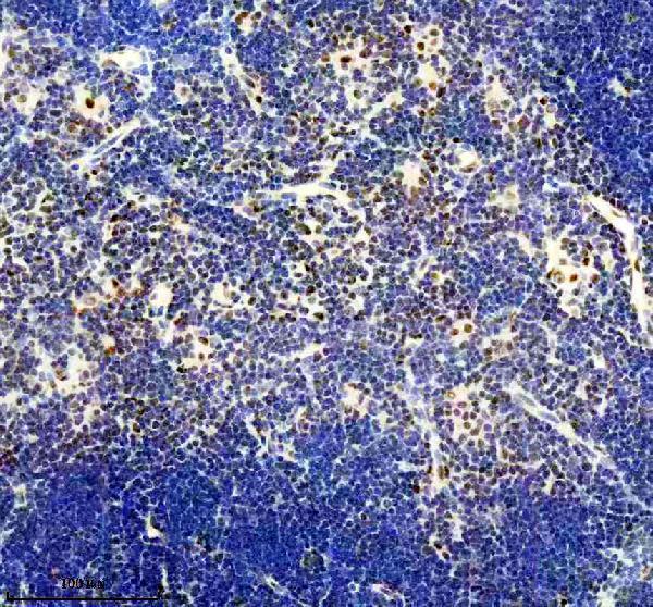 IHC analysis of PBRM1 using anti-PBRM1 antibody (M01130)