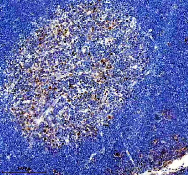 IHC analysis of PBRM1 using anti-PBRM1 antibody (M01130)