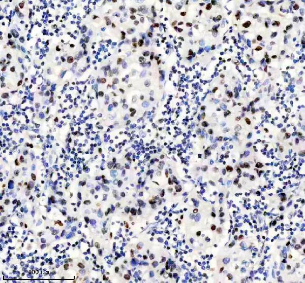 m01130 pbrm1 primary antibodies ihc testing 3