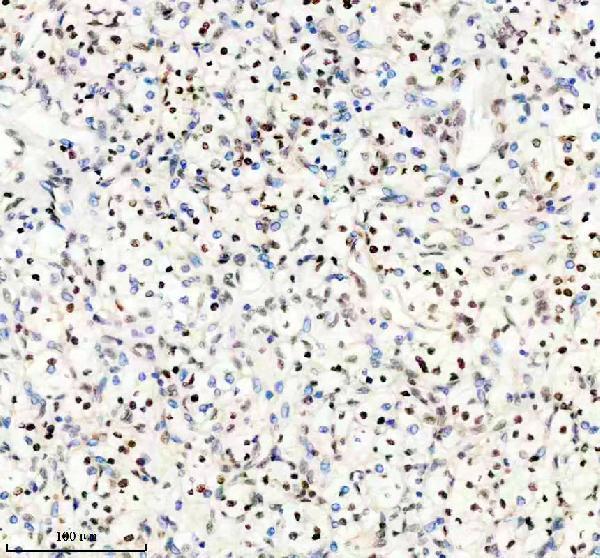 m01130 pbrm1 primary antibodies ihc testing 4