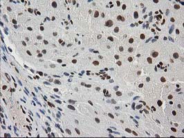 Immunohistochemical staining of paraffin-embedded Human Ovary tissue within the normal limits using anti-MEF2C mouse monoclonal antibody