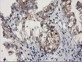 m01131 1 anti mef2c mouse monoclonal antibody clone id oti4f7 ihc testing 4
