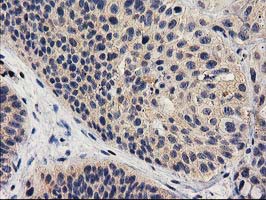 m01131 1 anti mef2c mouse monoclonal antibody clone id oti4f7 ihc testing 6