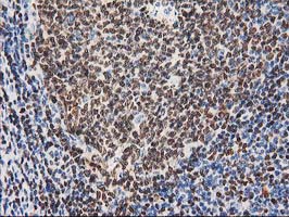 m01131 1 anti mef2c mouse monoclonal antibody clone id oti4f7 ihc testing 7