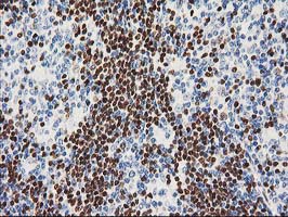 m01131 1 anti mef2c mouse monoclonal antibody clone id oti4f7 ihc testing 8