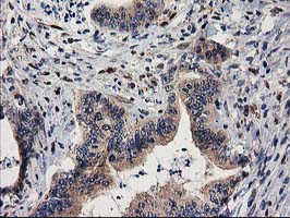 m01131 1 anti mef2c mouse monoclonal antibody clone id oti4f7 ihc testing 9