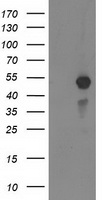 HEK293T cells were transfected with the pCMV6-ENTRY control (Left lane) or pCMV6-ENTRY MEF2C (Right lane) cDNA for 48 hrs and lysed