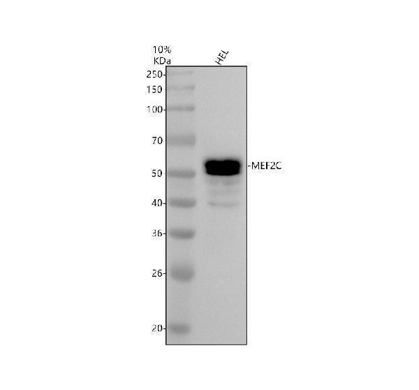 Western blot analysis of MEF2C using anti-MEF2C antibody (M01131-2)