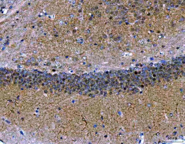  IHC analysis of MEF2A+MEF2C using anti-MEF2A+MEF2C antibody (M01131)