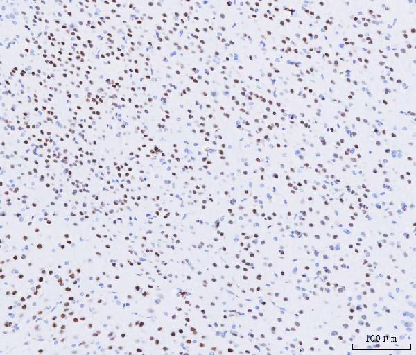 IHC analysis of MEF2A+MEF2C using anti-MEF2A+MEF2C antibody (M01131)