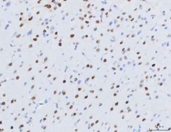 m01131 mef2a mef2c primary antibodies ihc testing 4