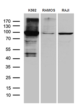 Western blot analysis of extracts (35ug) from 3 different cell lines by using anti-TTK monoclonal antibody (1:500)