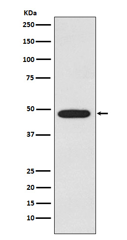 Western blot analysis of Galactosidase alpha expression in MCF-7 cell lysate