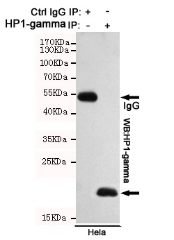 m01142 cbx3 primary antiboties ip testing 4