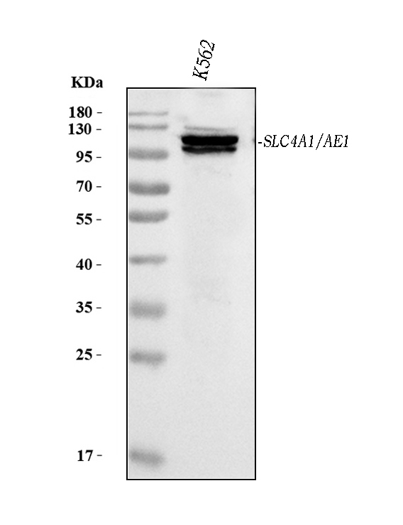 m01146 1 band 3 primary antibodies wb testing 1