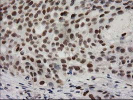 m01151 1 anti pkc epsilon prkce mouse monoclonal antibody clone id oti2a12 ihc testing 8