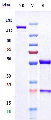 Anti-IL-12b Reference Antibody (ebdarokimab) on SDS-PAGE under reducing (R) condition
