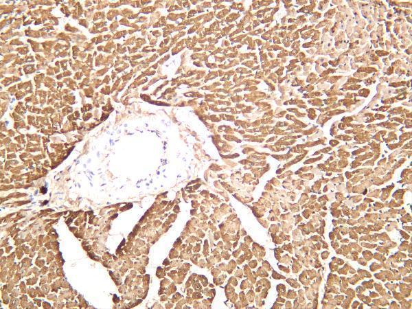 Rat cardiac muscle was stained with anti-Cardiac Troponin T rabbit antibody
