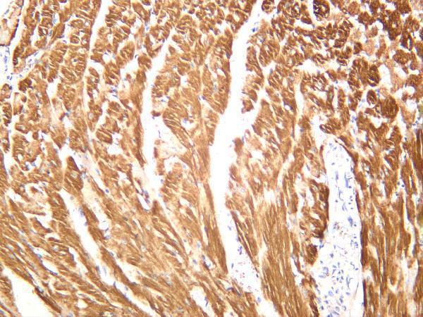 Mouse cardiac muscle was stained with anti-Cardiac Troponin T rabbit antibody