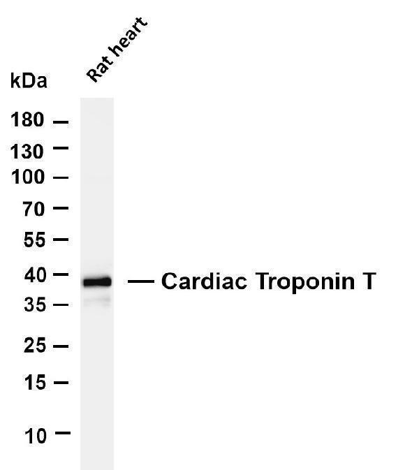 Various whole cell lysates were separated by 4-20% SDS-PAGE, and the membrane was blotted with anti-Cardiac Troponin T antibody