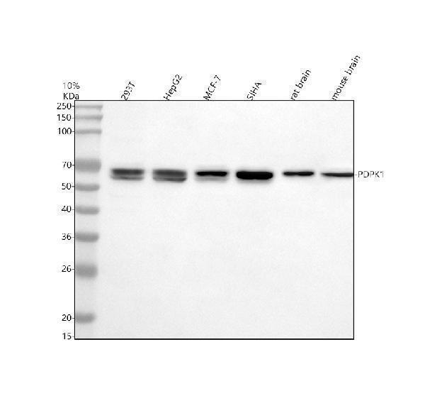 Western blot analysis of PDPK1 using anti-PDPK1 antibody (M01159)
