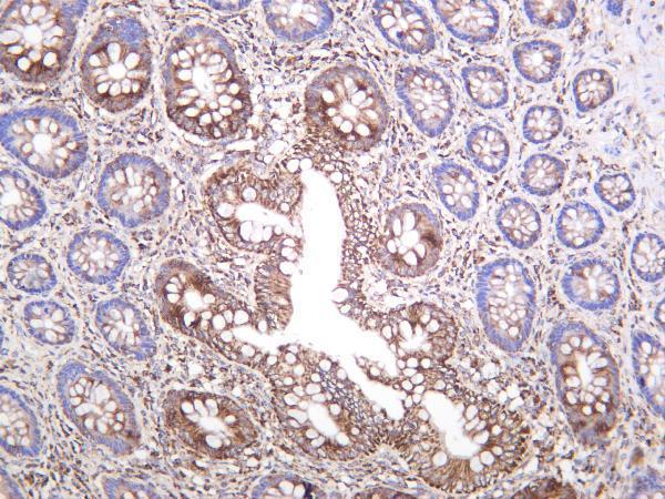 Human colon was stained with anti-Bak rabbit antibody
