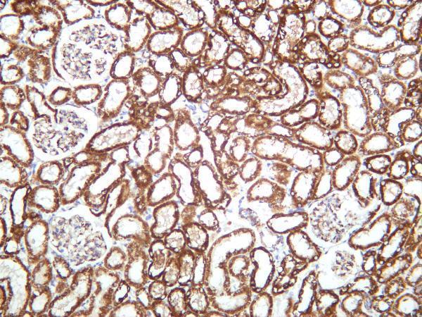 m01168 1 vdac1 primary antibodies ihc testing 4