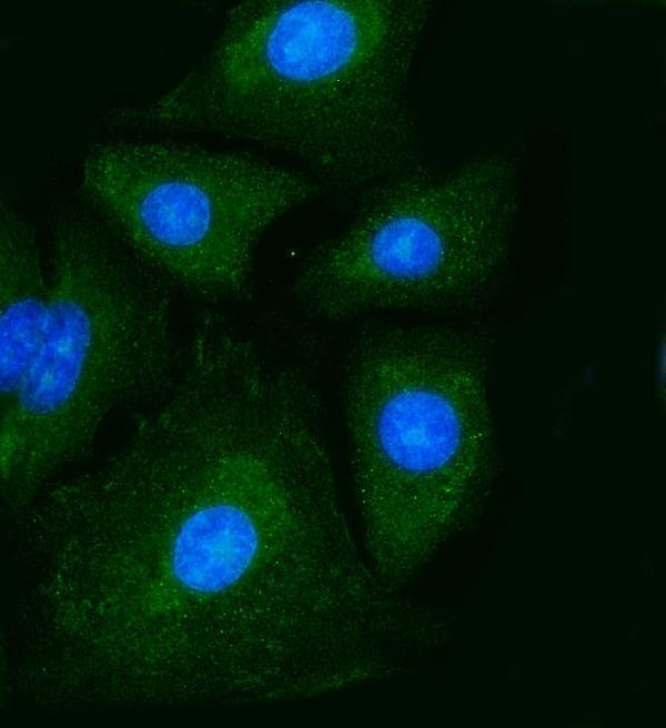 m01173 1 pkm primary antibodies if testing 4