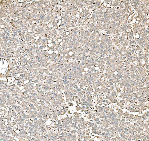  IHC analysis of PKM2 using anti-PKM2 antibody (M01173-1)