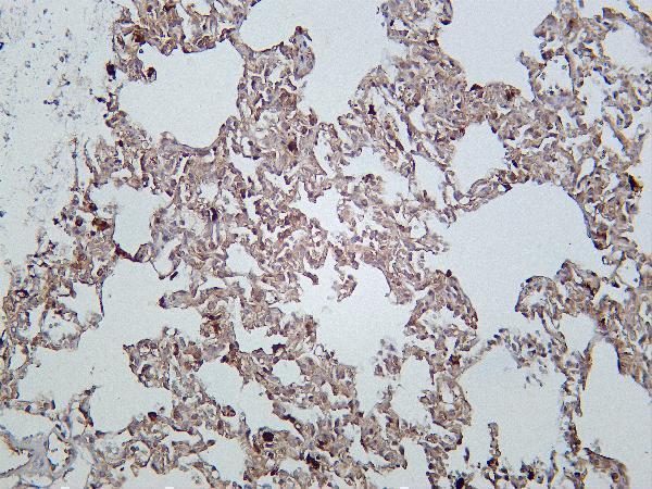 Rat lung was stained with Anti-PKM rabbit antibody