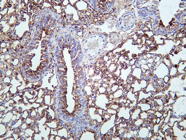 Mouse lung was stained with Anti-PKM rabbit antibody