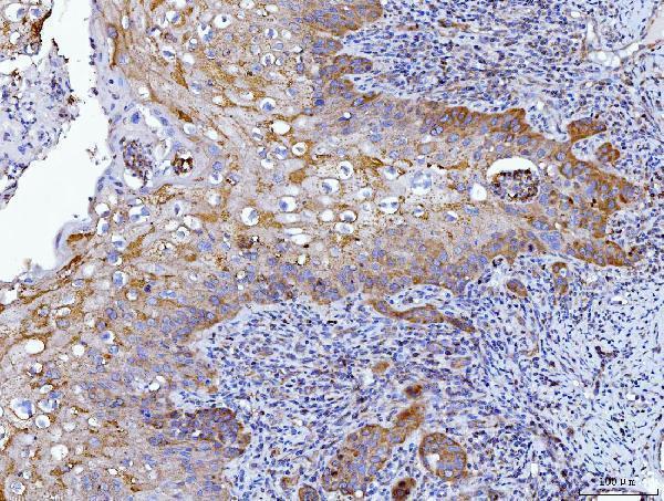  IHC analysis of HGS using anti-HGS antibody (M01174-1)