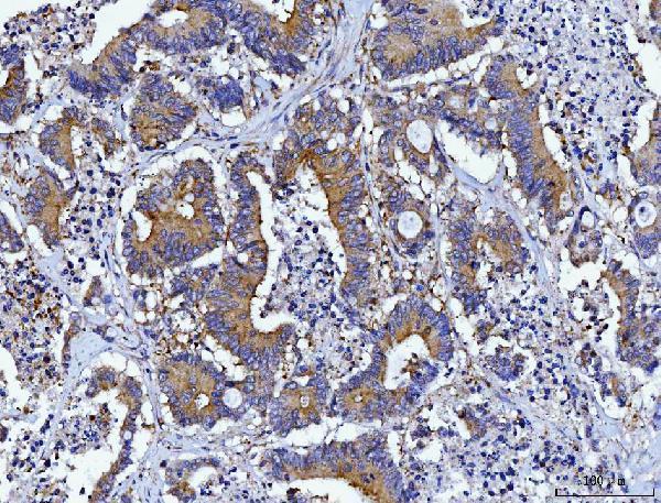  IHC analysis of HGS using anti-HGS antibody (M01174-1)